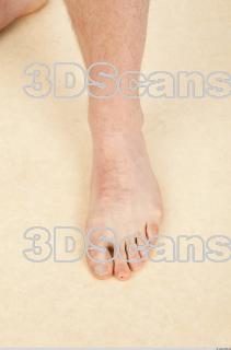 Photo reference of foot 0002